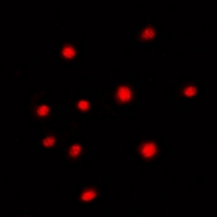 Immunofluorescent analysis of SUR2 staining in Hela cells. Formalin-fixed cells were permeabilized with 0.1% Triton X-100 in TBS for 5-10 minutes and blocked with 3% BSA-PBS for 30 minutes at room temperature. Cells were probed with the primary antibody in 3% BSA-PBS and incubated overnight at 4 deg C in a hidified chamber. Cells were washed with PBST and incubated with a DyLight 594-conjugated secondary antibody (red) in PBS at room temperature in the dark. DAPI was used to stain the cell nuclei (blue).