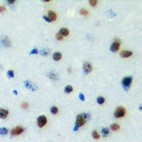 Immunohistochemical analysis of DYRK1B staining in human brain formalin fixed paraffin embedded tissue section. The section was pre-treated using heat mediated antigen retrieval with sodium citrate buffer (pH 6.0). The section was then incubated with the antibody at room temperature and detected using an HRP conjugacompact polymer system. DAB was used as the chromogen. The section was then counterstained with haematoxylin and mounted with DPX.