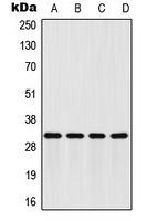 Western blot analysis of FHL2 expression in HeLa (A); HepG2 (B); mouse brain (C); H9C2 (D) whole cell lysates.