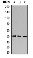 Western blot analysis of B4GALT1 expression in HL60 (A); HEK293T (B); Jurkat (C) whole cell lysates.
