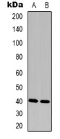 Western blot analysis of FAM203A expression in Hela (A); Colo320 (B) whole cell lysates.