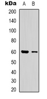 Western blot analysis of CLIP3 expression in human brain (A); A549 (B) whole cell lysates.