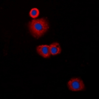 Immunofluorescent analysis of CLIP3 staining in A549 cells. Formalin-fixed cells were permeabilized with 0.1% Triton X-100 in TBS for 5-10 minutes and blocked with 3% BSA-PBS for 30 minutes at room temperature. Cells were probed with the primary antibody in 3% BSA-PBS and incubated overnight at 4 deg C in a hidified chamber. Cells were washed with PBST and incubated with a DyLight 594-conjugated secondary antibody (red) in PBS at room temperature in the dark. DAPI was used to stain the cell nuclei (blue).