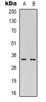 Western blot analysis of CDC42EP4 expression in Hela (A); Jurkat (B) whole cell lysates.