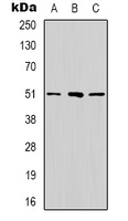 Western blot analysis of RRP8 expression in Hela (A); MCF7 (B); Hela (C) whole cell lysates.