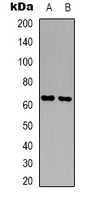 Western blot analysis of Copine 8 expression in A431 (A); NIH3T3 (B) whole cell lysates.