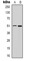 Western blot analysis of GABRD expression in HT29 (A); PC12 (B) whole cell lysates.
