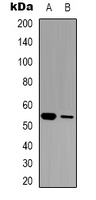 Western blot analysis of GABRG1 expression in LOVO (A); mouse brain (B) whole cell lysates.