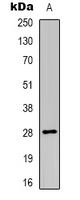 Western blot analysis of HLA-DOA expression in HL60 (A) whole cell lysates.