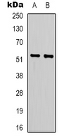 Western blot analysis of LIPI expression in Jurkat (A); HepG2 (B) whole cell lysates.