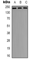 Western blot analysis of NUMA expression in Hela (A); A431 (B); A549 (C) whole cell lysates.