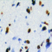Immunohistochemical analysis of LUC7L2 staining in human brain formalin fixed paraffin embedded tissue section. The section was pre-treated using heat mediated antigen retrieval with sodium citrate buffer (pH 6.0). The section was then incubated with the antibody at room temperature and detected using an HRP conjugacompact polymer system. DAB was used as the chromogen. The section was then counterstained with haematoxylin and mounted with DPX.