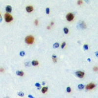 Immunohistochemical analysis of PWWP2B staining in human brain formalin fixed paraffin embedded tissue section. The section was pre-treated using heat mediated antigen retrieval with sodium citrate buffer (pH 6.0). The section was then incubated with the antibody at room temperature and detected using an HRP conjugacompact polymer system. DAB was used as the chromogen. The section was then counterstained with haematoxylin and mounted with DPX.