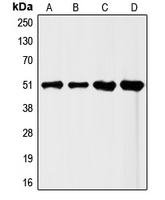 Western blot analysis of FLI1 expression in HeLa (A); Jurkat (B); mouse liver (C); rat liver (D) whole cell lysates.