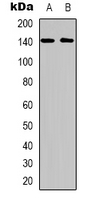 Western blot analysis of QSK expression in MCF7 (A); HEK293T (B) whole cell lysates.
