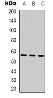 Western blot analysis of SESN1 expression in K562 (A); Hela (B); rat muscle (C) whole cell lysates.