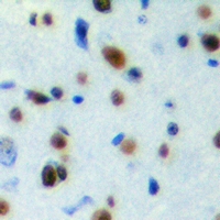 Immunohistochemical analysis of SESN1 staining in human brain formalin fixed paraffin embedded tissue section. The section was pre-treated using heat mediated antigen retrieval with sodium citrate buffer (pH 6.0). The section was then incubated with the antibody at room temperature and detected using an HRP conjugacompact polymer system. DAB was used as the chromogen. The section was then counterstained with haematoxylin and mounted with DPX.