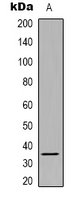Western blot analysis of SRSF8 expression in Hela (A) whole cell lysates.