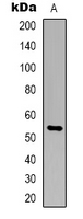 Western blot analysis of TIGD3 expression in Jurkat (A) whole cell lysates.