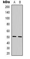 Western blot analysis of TBL2 expression in Ramos (A); MCF7 (B) whole cell lysates.