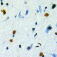 Immunohistochemical analysis of TBL2 staining in human brain formalin fixed paraffin embedded tissue section. The section was pre-treated using heat mediated antigen retrieval with sodium citrate buffer (pH 6.0). The section was then incubated with the antibody at room temperature and detected using an HRP conjugacompact polymer system. DAB was used as the chromogen. The section was then counterstained with haematoxylin and mounted with DPX.