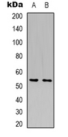 Western blot analysis of GLUT5 expression in Hela (A); HepG2 (B) whole cell lysates.