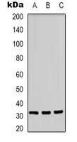 Western blot analysis of CD300f expression in A431 (A); Jurkat (B); PC12 (C) whole cell lysates.