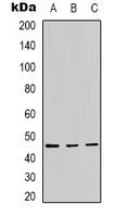Western blot analysis of Panopsin expression in Hela (A); A431 (B); mouse brain (C) whole cell lysates.