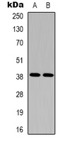 Western blot analysis of EDG5 expression in Hela (A); A10 (B) whole cell lysates.