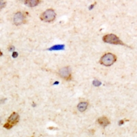 Immunohistochemical analysis of EDG5 staining in human brain formalin fixed paraffin embedded tissue section. The section was pre-treated using heat mediated antigen retrieval with sodium citrate buffer (pH 6.0). The section was then incubated with the antibody at room temperature and detected using an HRP conjugacompact polymer system. DAB was used as the chromogen. The section was then counterstained with haematoxylin and mounted with DPX.