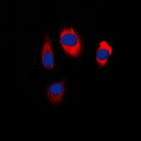 Immunofluorescent analysis of EDG5 staining in Hela cells. Formalin-fixed cells were permeabilized with 0.1% Triton X-100 in TBS for 5-10 minutes and blocked with 3% BSA-PBS for 30 minutes at room temperature. Cells were probed with the primary antibody in 3% BSA-PBS and incubated overnight at 4 deg C in a hidified chamber. Cells were washed with PBST and incubated with a DyLight 594-conjugated secondary antibody (red) in PBS at room temperature in the dark. DAPI was used to stain the cell nuclei (blue).