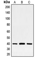 Western blot analysis of FRA2 expression in HeLa (A); MCF7 (B); PC12 (C) whole cell lysates.