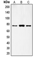 Western blot analysis of FSHR expression in HeLa (A); A431 (B); H1299 (C) whole cell lysates.