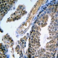 Immunohistochemical analysis of FSHR staining in human testis formalin fixed paraffin embedded tissue section. The section was pre-treated using heat mediated antigen retrieval with sodium citrate buffer (pH 6.0). The section was then incubated with the antibody at room temperature and detected using an HRP conjugated compact polymer system. DAB was used as the chromogen. The section was then counterstained with haematoxylin and mounted with DPX.
