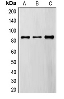 Western blot analysis of FYB expression in A549 (A); MDAMB435 (B); TF1 (C) whole cell lysates.