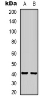 Western blot analysis of HAO1 expression in mouse liver (A); rat liver (B) whole cell lysates.