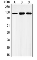 Western blot analysis of GABBR1 expression in HEK293T (A); mouse heart (B); rat heart (C) whole cell lysates.