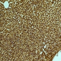 Immunohistochemical analysis of PI3K p85 alpha staining in rat liver;mouse brain formalin fixed paraffin embedded tissue section. The section was pre-treated using heat mediated antigen retrieval with sodium citrate buffer (pH 6.0). The section was then incubated with the antibody at room temperature and detected using an HRP conjugated compact polymer system. DAB was used as the chromogen. The section was then counterstained with haematoxylin and mounted with DPX.