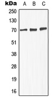 Western blot analysis of GABRA4 expression in MCF7 (A); SP2/0 (B); PC12 (C) whole cell lysates.