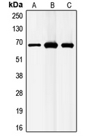 Western blot analysis of GABRB1 expression in MCF7 (A); mouse liver (B); rat liver (C) whole cell lysates.