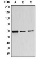 Western blot analysis of B4GALNT1 expression in MDAMB453 (A); A549 (B); K562 (C) whole cell lysates.