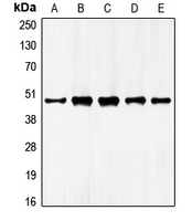 Western blot analysis of GATA4 expression in HepG2 (A); NIH3T3 (B); mouse liver (C); rat liver (D); rat kidney (E) whole cell lysates.