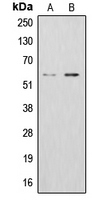 Western blot analysis of ALDH1B1 expression in K562 (A); HepG2 (B) whole cell lysates.