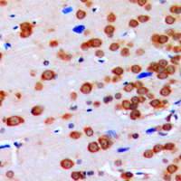 Immunohistochemical analysis of GBP3 staining in human brain formalin fixed paraffin embedded tissue section. The section was pre-treated using heat mediated antigen retrieval with sodium citrate buffer (pH 6.0). The section was then incubated with the antibody at room temperature and detected using an HRP conjugated compact polymer system. DAB was used as the chromogen. The section was then counterstained with haematoxylin and mounted with DPX.