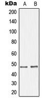 Western blot analysis of GHRH Receptor expression in SKNSH (A); LOVO (B) whole cell lysates.
