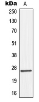 Western blot analysis of Connexin 26 expression in HepG2 (A) whole cell lysates.