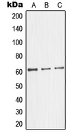 Western blot analysis of Glycerol Kinase 2 expression in HepG2 (A); HeLa (B); Jurkat (C) whole cell lysates.