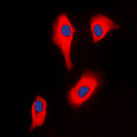 Immunofluorescent analysis of Glycerol Kinase 2 staining in HeLa cells. Formalin-fixed cells were permeabilized with 0.1% Triton X-100 in TBS for 5-10 minutes and blocked with 3% BSA-PBS for 30 minutes at room temperature. Cells were probed with the primary antibody in 3% BSA-PBS and incubated overnight at 4 C in a humidified chamber. Cells were washed with PBST and incubated with a DyLight 594-conjugated secondary antibody (red) in PBS at room temperature in the dark. DAPI was used to stain the cell nuclei (blue).
