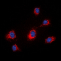 Immunofluorescent analysis of MID1 staining in HeLa cells. Formalin-fixed cells were permeabilized with 0.1% Triton X-100 in TBS for 5-10 minutes and blocked with 3% BSA-PBS for 30 minutes at room temperature. Cells were probed with the primary antibody in 3% BSA-PBS and incubated overnight at 4 deg C in a hidified chamber. Cells were washed with PBST and incubated with a DyLight 594-conjugated secondary antibody (red) in PBS at room temperature in the dark. DAPI was used to stain the cell nuclei (blue).