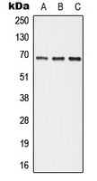 Western blot analysis of ALPI expression in HepG2 (A); Raw264.7 (B); PC12 (C) whole cell lysates.